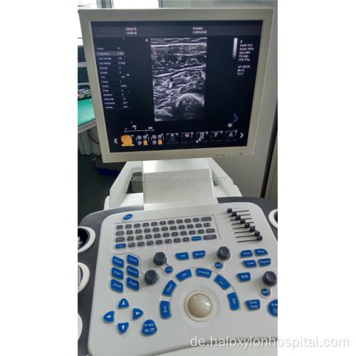 Full Digital 4D Laptop Color Doppler Ultraschallmaschine